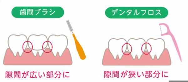 ブログイラスト_コピー